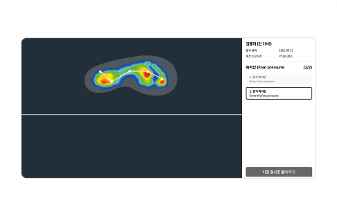 동적 족저압 측정 이미지